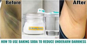 Can I use baking powder instead of baking soda for hair? - can i use baking powder instead of baking soda for hair Can I use baking powder instead of baking soda for hair? - can i use baking powder instead of baking soda for hair